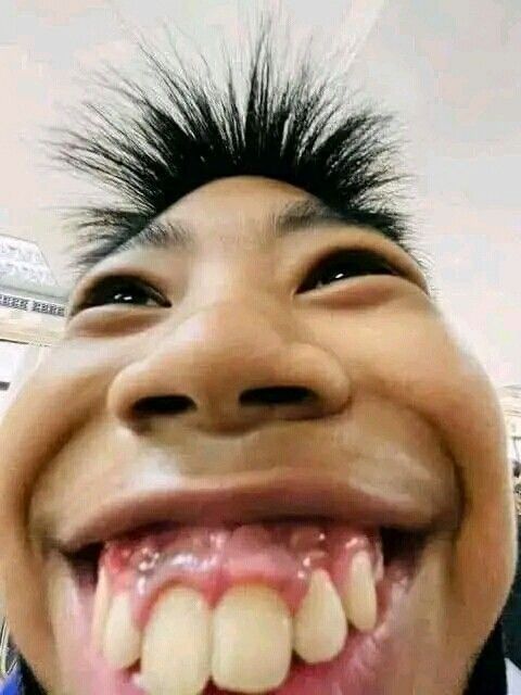 😭🤣j’avais cru quelle ces pas brosser les dents 🥲