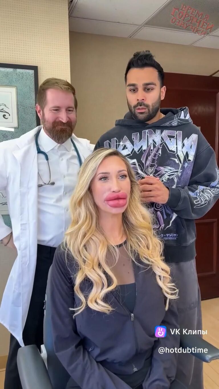 Когда она сделала губы👄