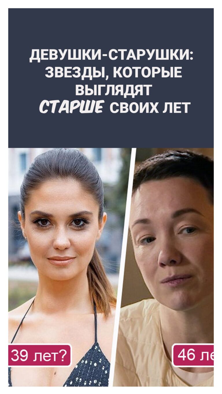 Девушки-старушки: звезды, которые выглядят старше своих лет